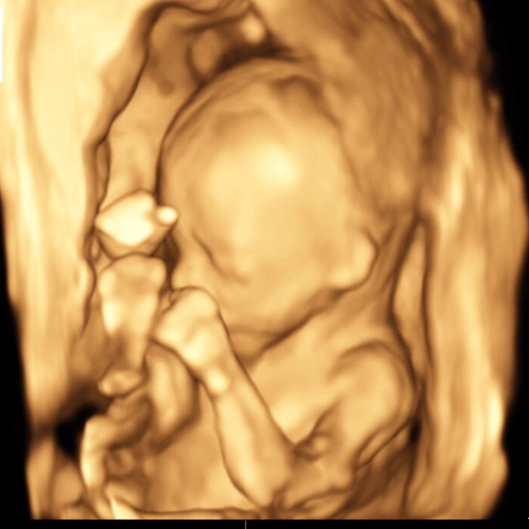 Photo shared by Amanda for their Babylist baby registry.