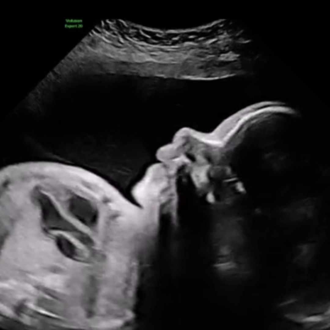 Photo shared by Shawna for their Babylist baby registry.