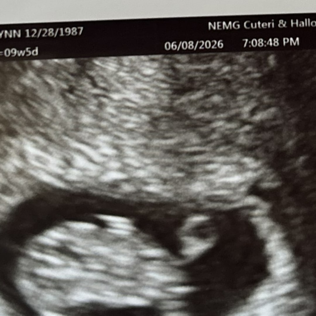 Photo shared by Katie for their Babylist baby registry.