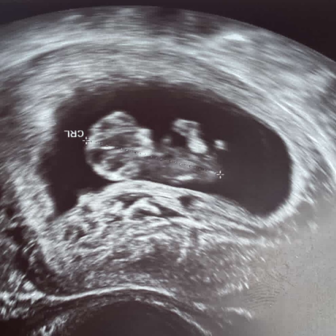 Photo shared by Jadaleis for their Babylist baby registry.
