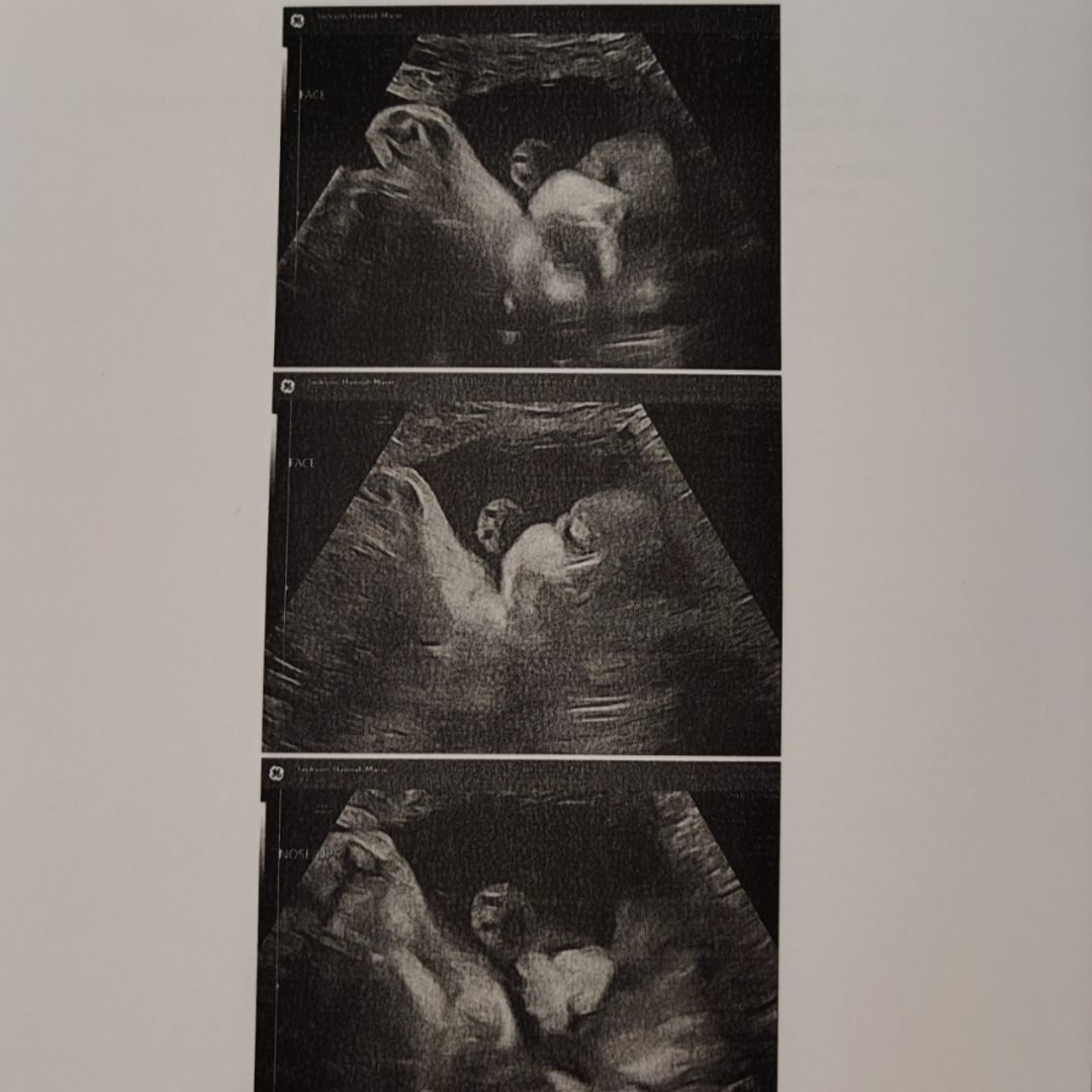Photo shared by Hannah for their Babylist baby registry.