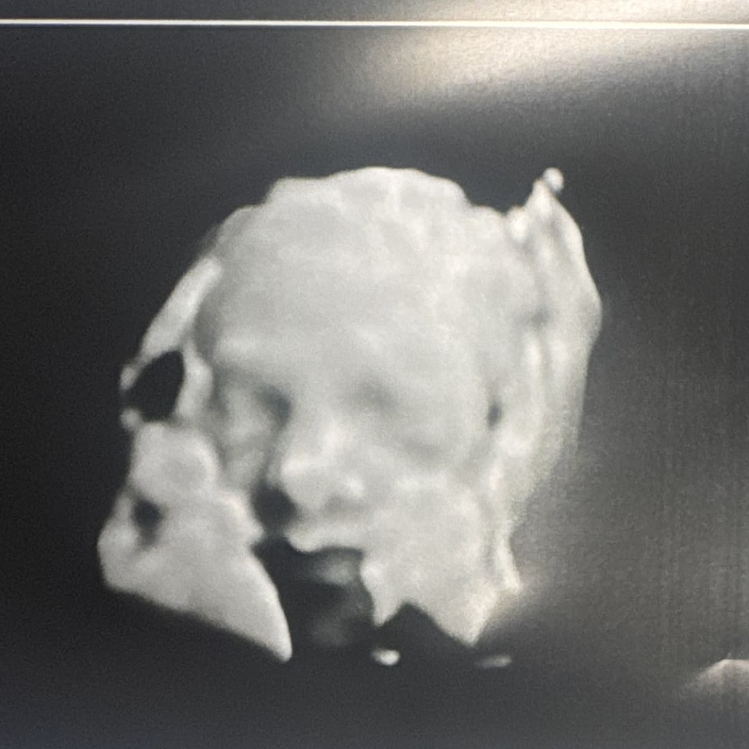 Photo shared by Kimberly for their Babylist baby registry.