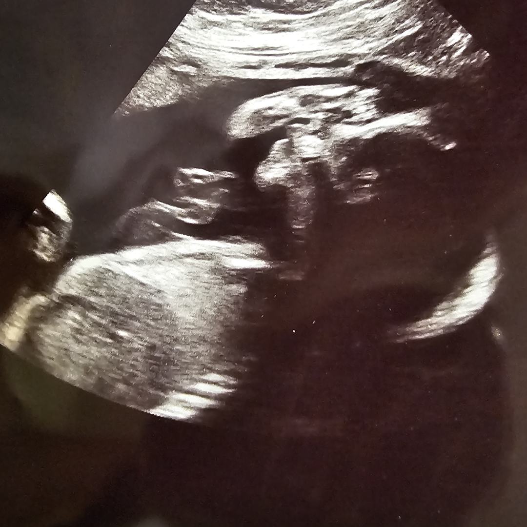 Photo shared by Dominique for their Babylist baby registry.