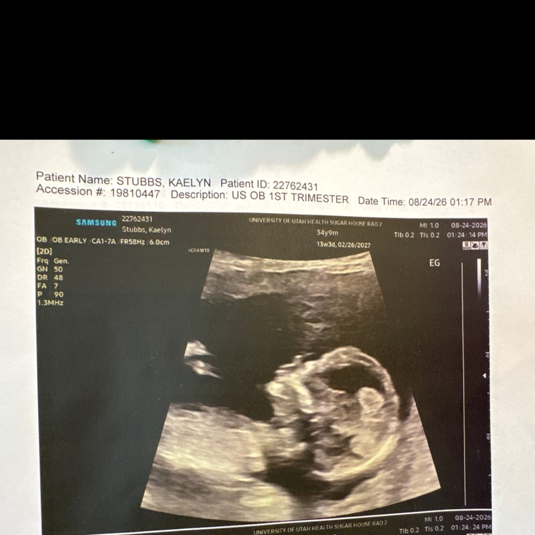 Photo shared by Kaelyn for their Babylist baby registry.