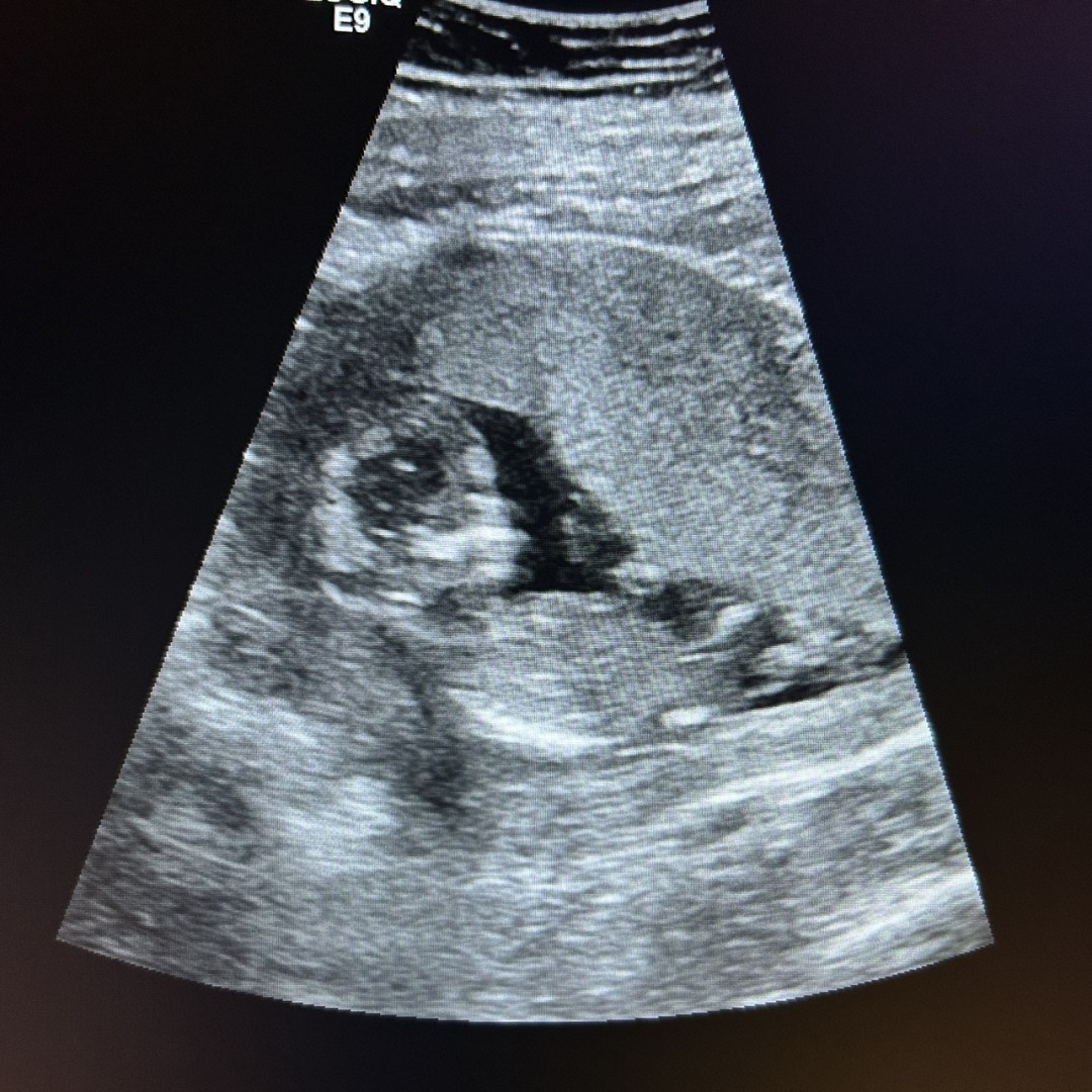 Photo shared by Alyssa for their Babylist baby registry.