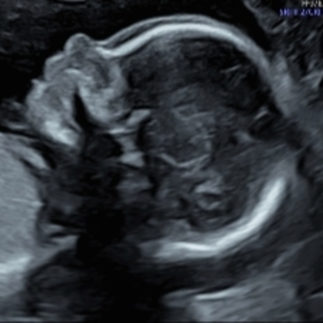 Photo shared by Casey for their Babylist baby registry.