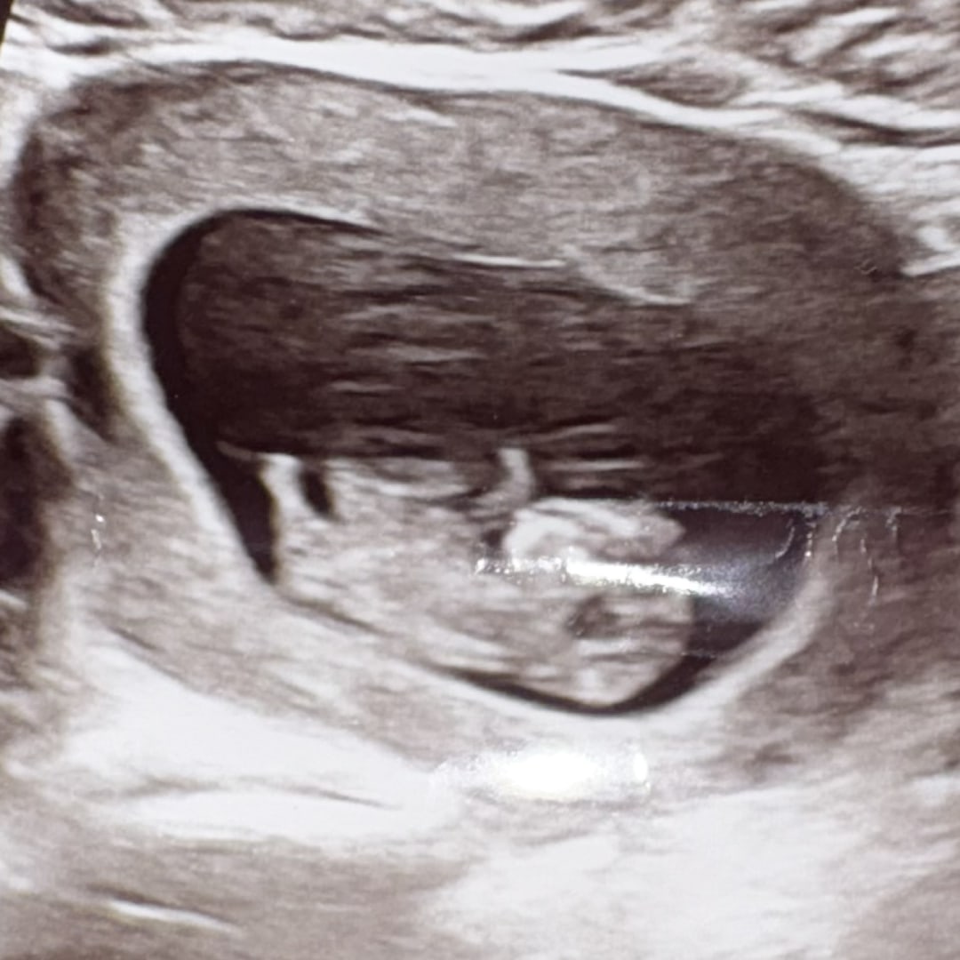 Photo shared by Vernisha for their Babylist baby registry.