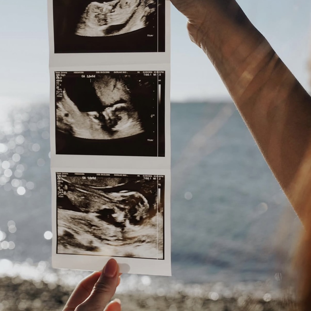Photo shared by Nomar for their Babylist baby registry.