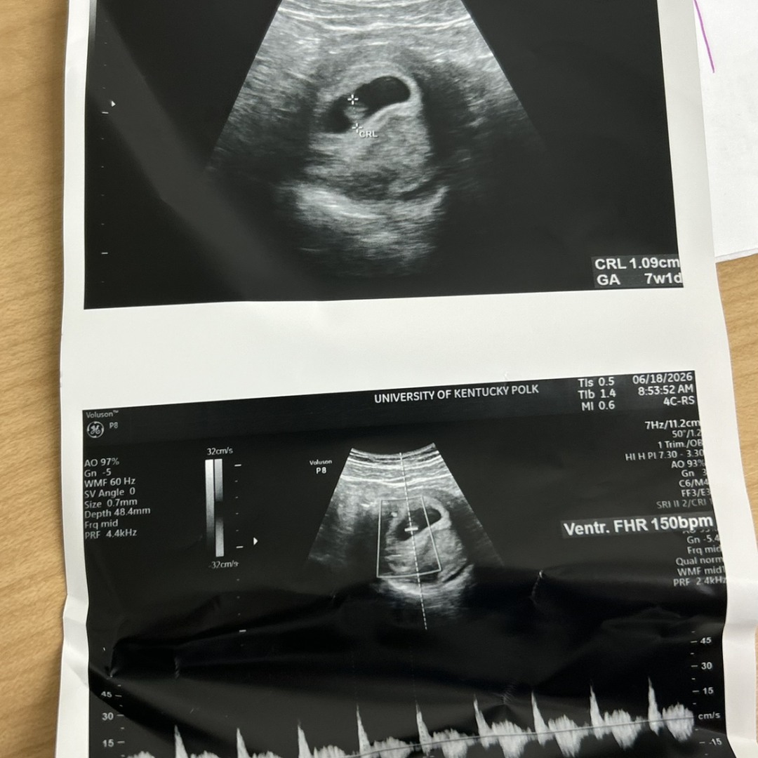 Photo shared by Alanna for their Babylist baby registry.