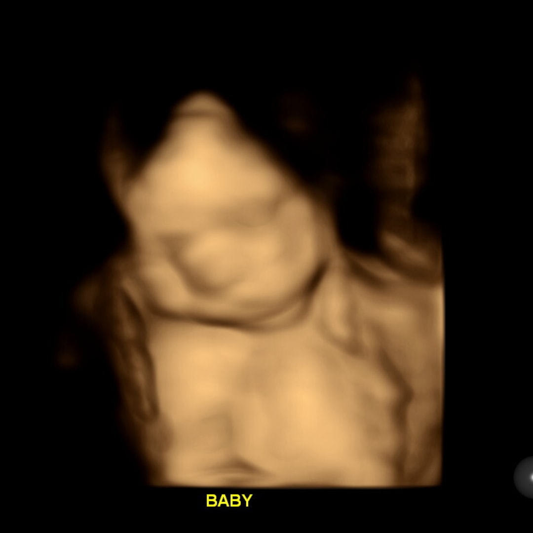 Photo shared by Dacia for their Babylist baby registry.