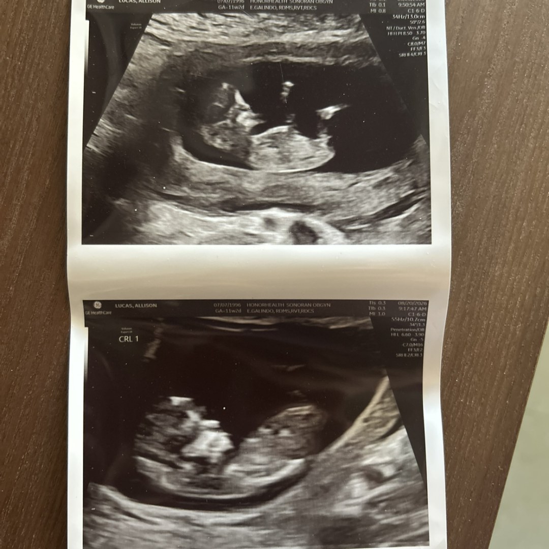 Photo shared by Allison for their Babylist baby registry.
