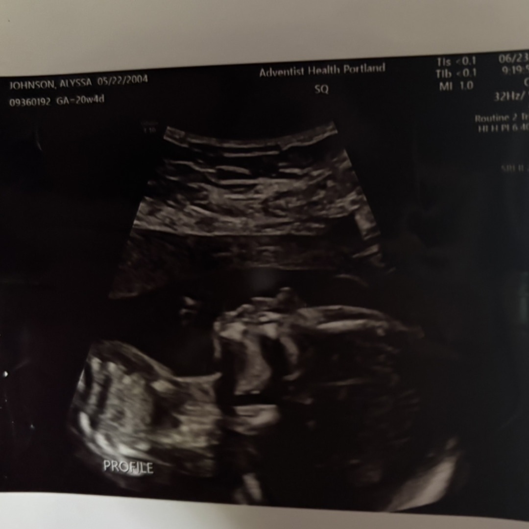 Photo shared by Alyssa for their Babylist baby registry.