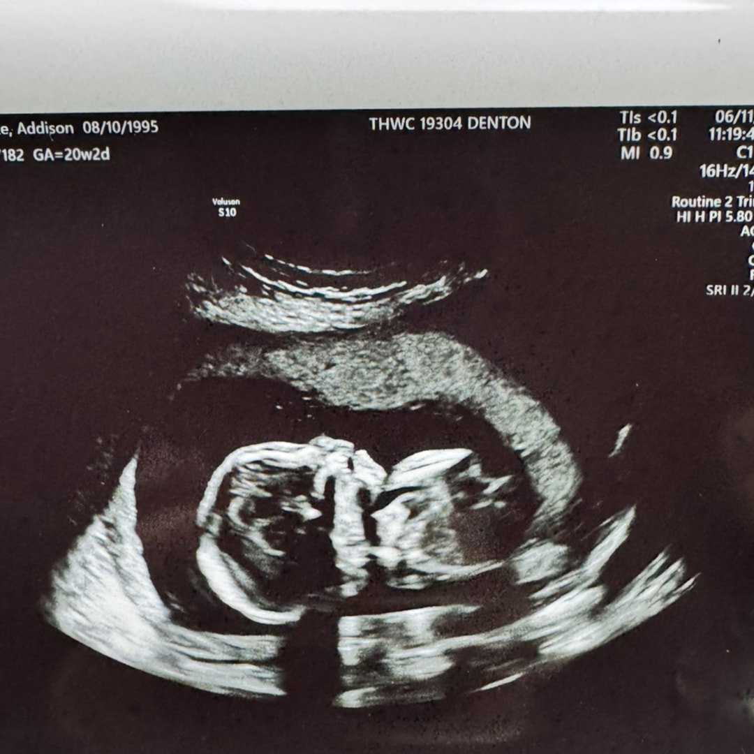 Photo shared by Addison for their Babylist baby registry.