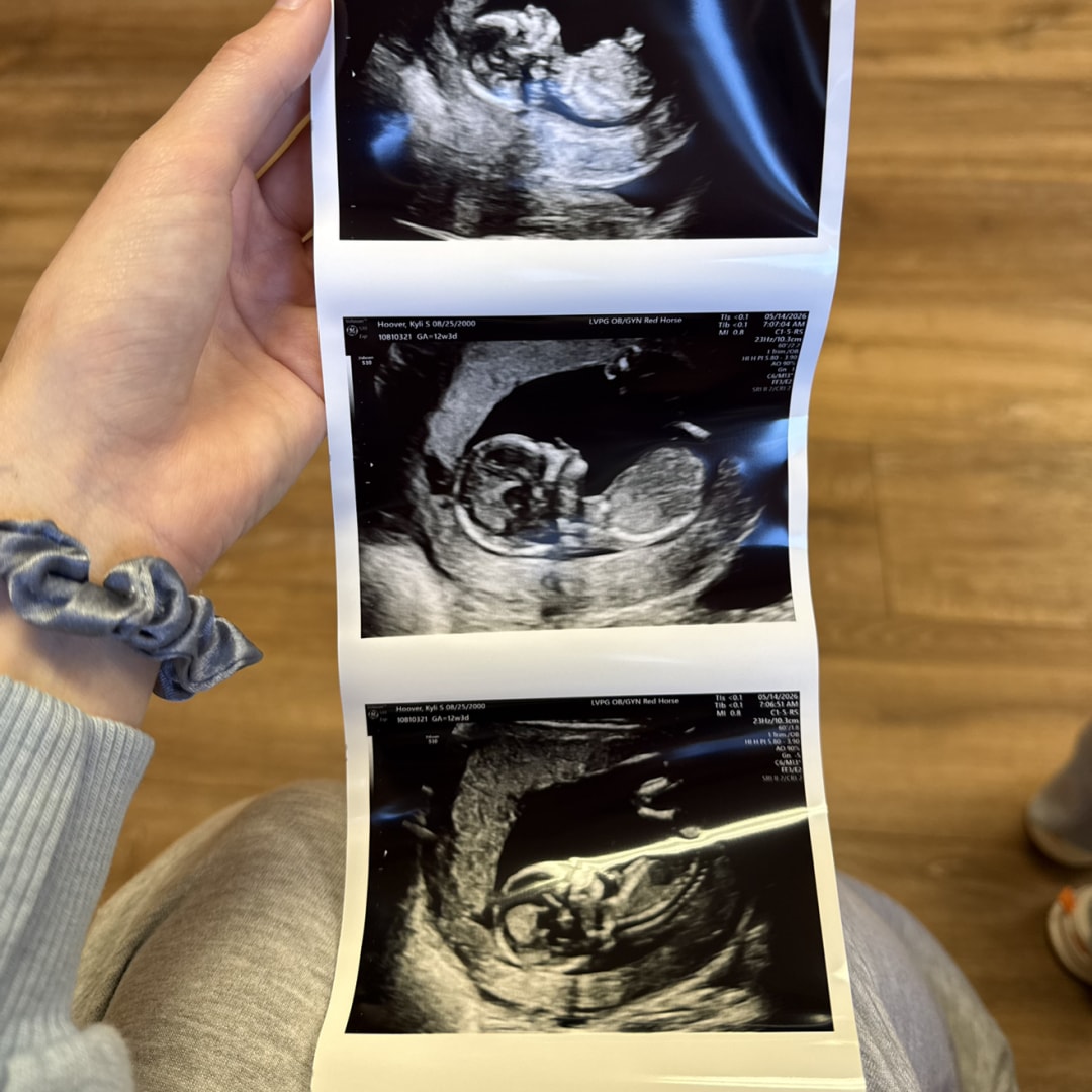 Photo shared by Kyli for their Babylist baby registry.