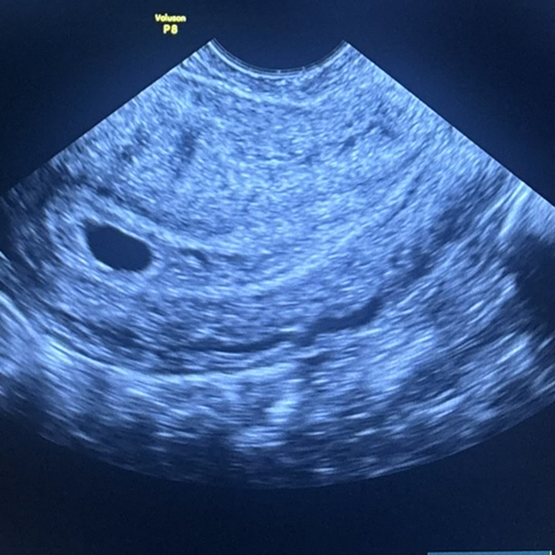 Photo shared by Cassandra for their Babylist baby registry.