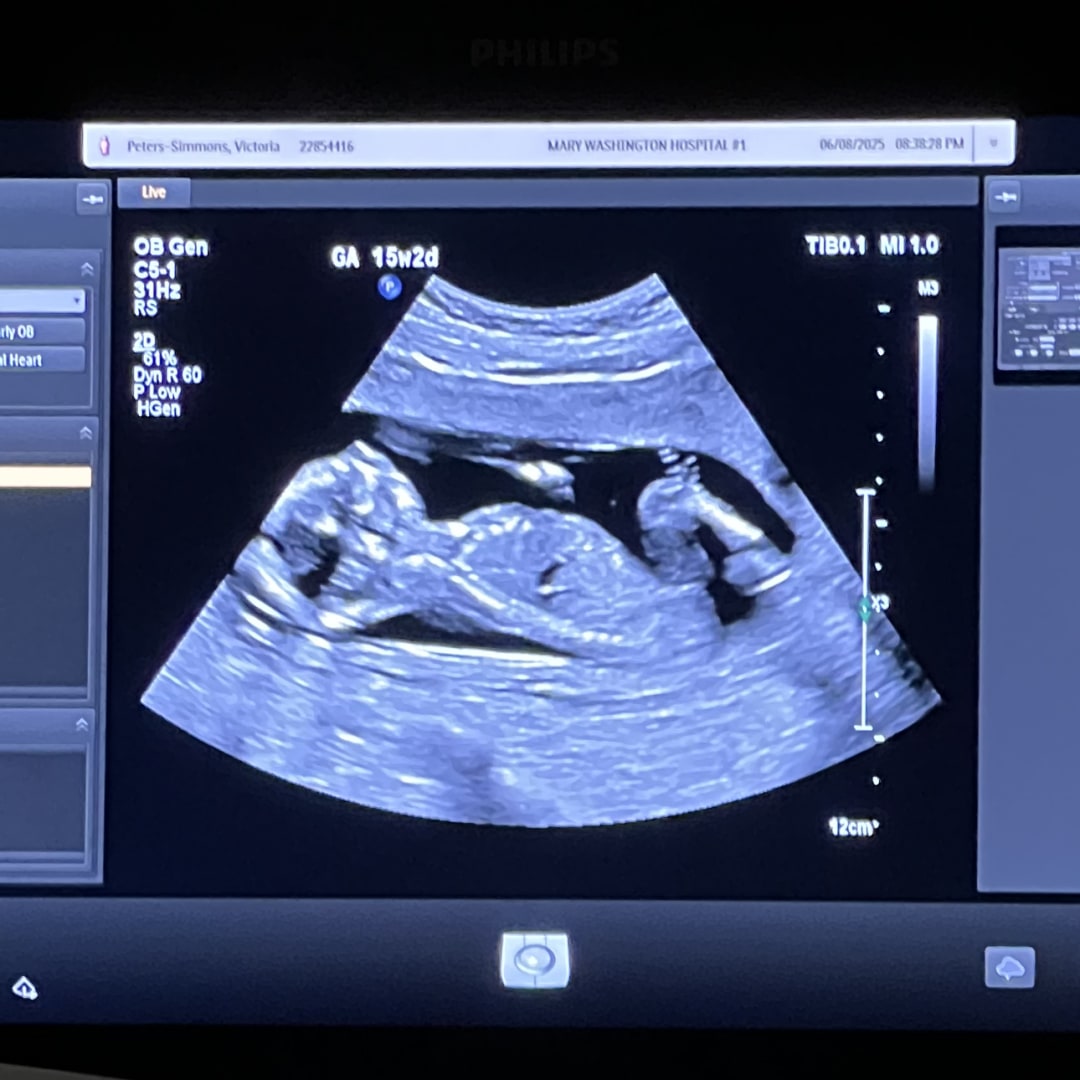 Photo shared by Victoria for their Babylist baby registry.