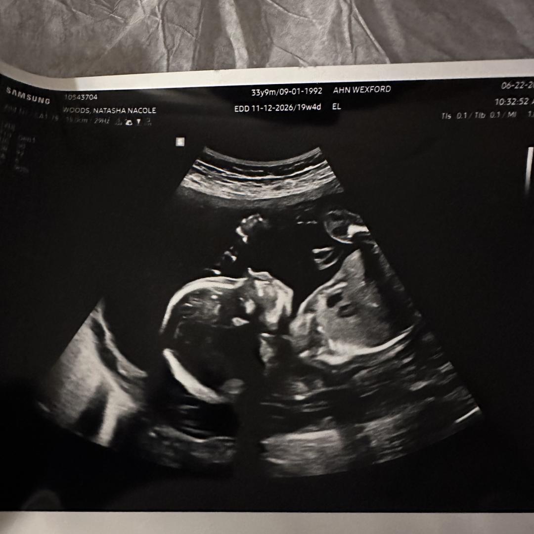 Photo shared by Nacole for their Babylist baby registry.