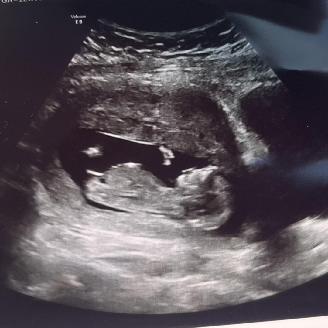 Photo shared by Courtney for their Babylist baby registry.