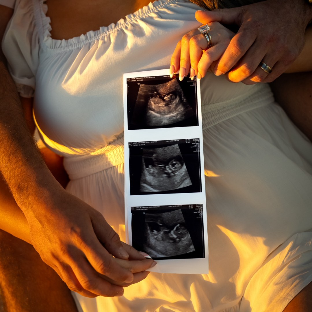 Photo shared by Alex for their Babylist baby registry.