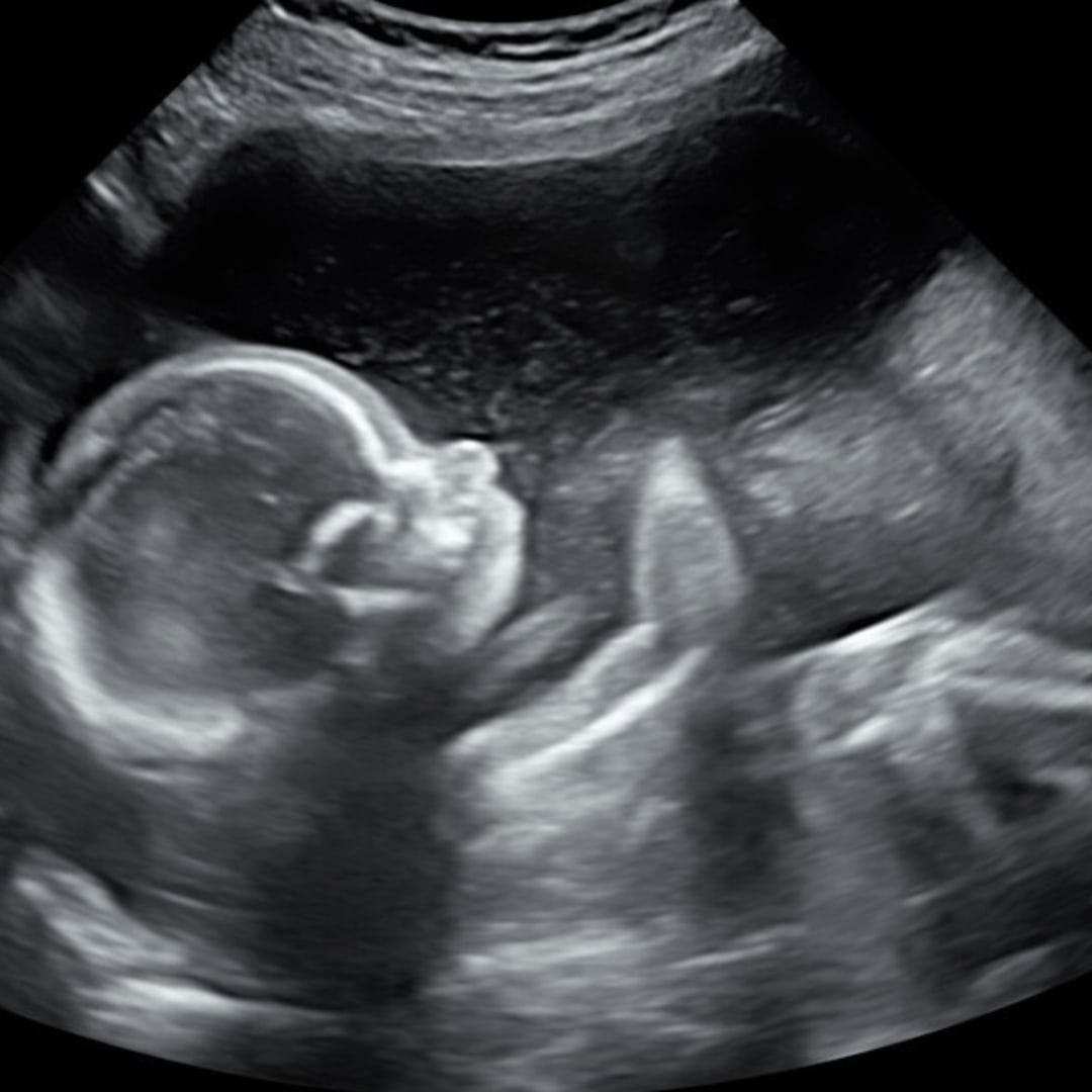 Photo shared by Amy for their Babylist baby registry.
