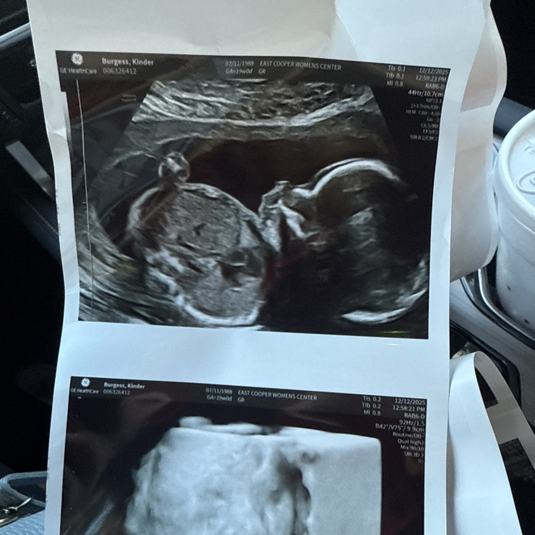 Photo shared by Louise for their Babylist baby registry.