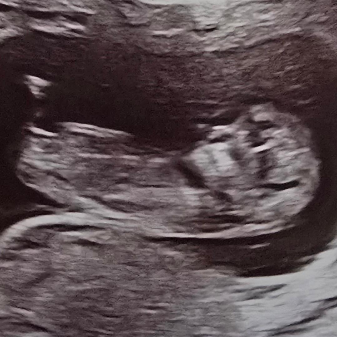 Photo shared by Samantha for their Babylist baby registry.