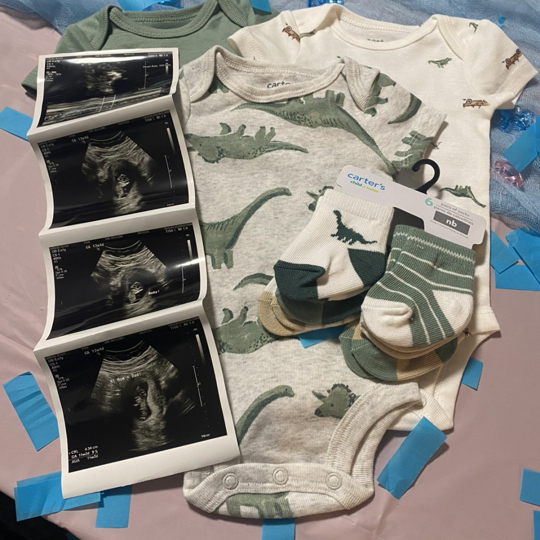 Photo shared by Christian for their Babylist baby registry.