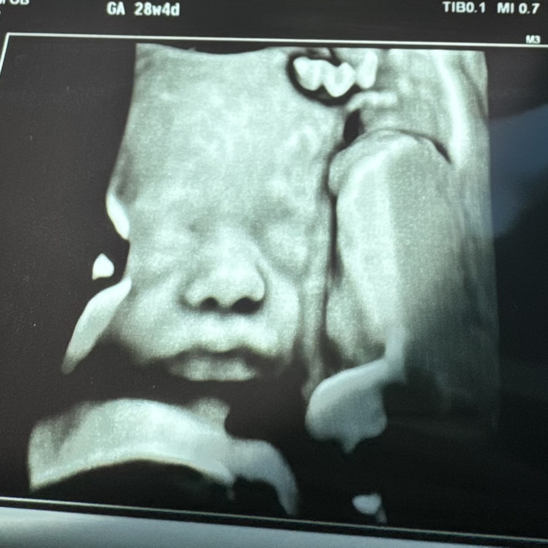 Photo shared by Raquel for their Babylist baby registry.