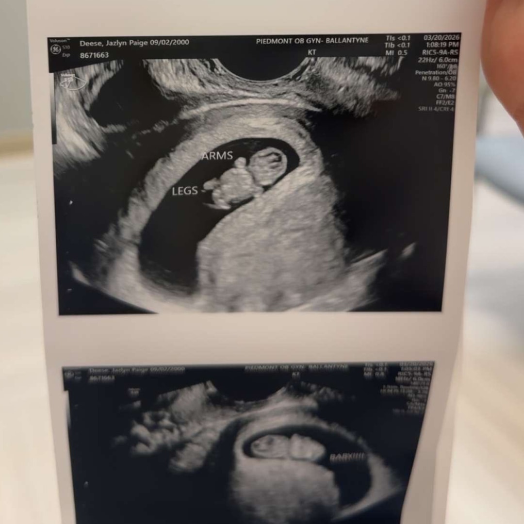 Photo shared by Jazlyn for their Babylist baby registry.
