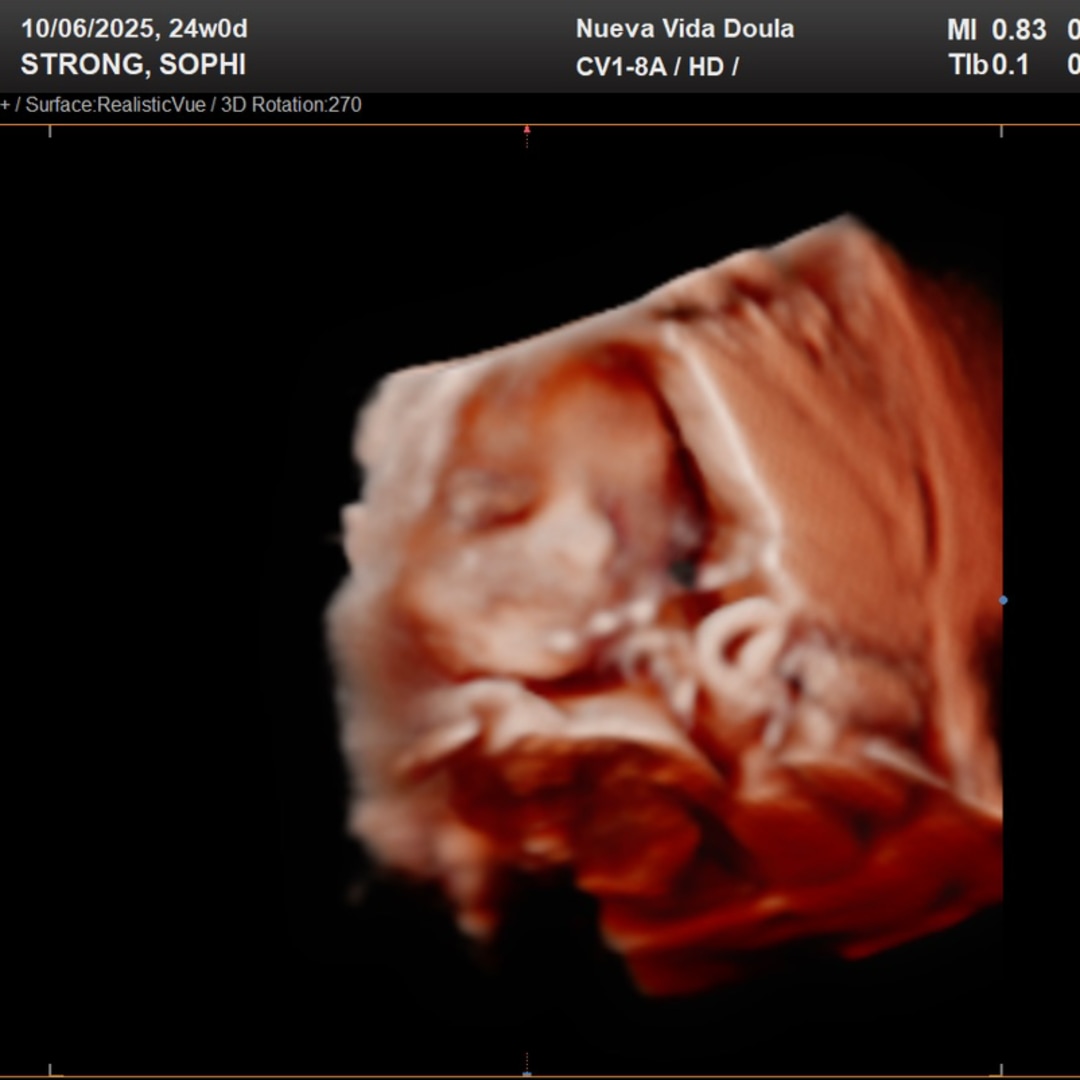 Photo shared by Sophia for their Babylist baby registry.