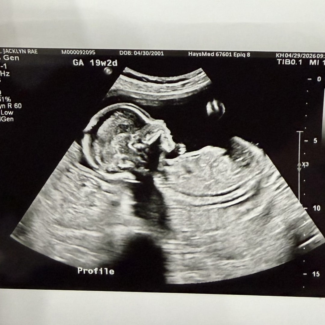 Photo shared by Jacklyn for their Babylist baby registry.