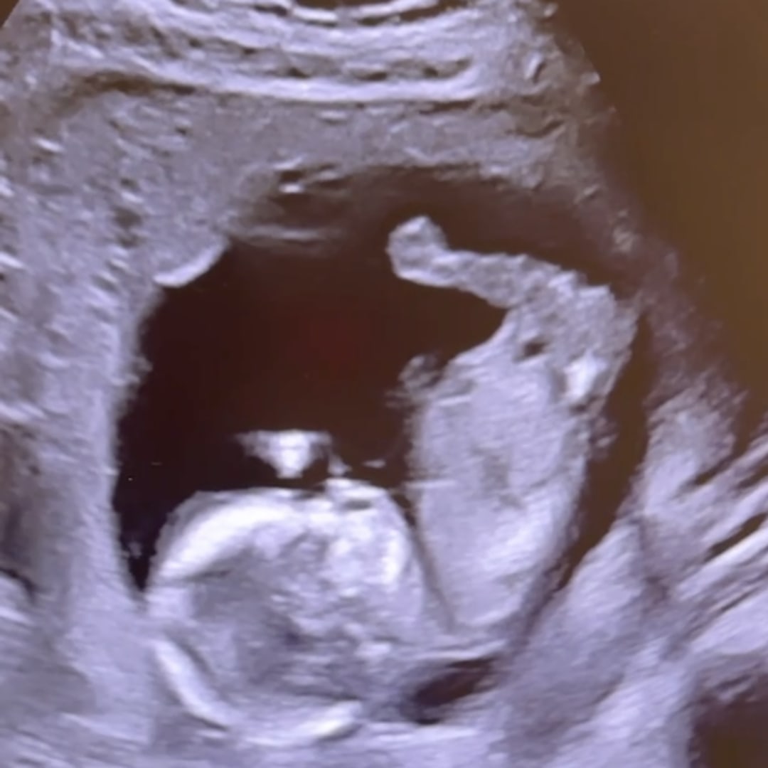 Photo shared by Anjali for their Babylist baby registry.