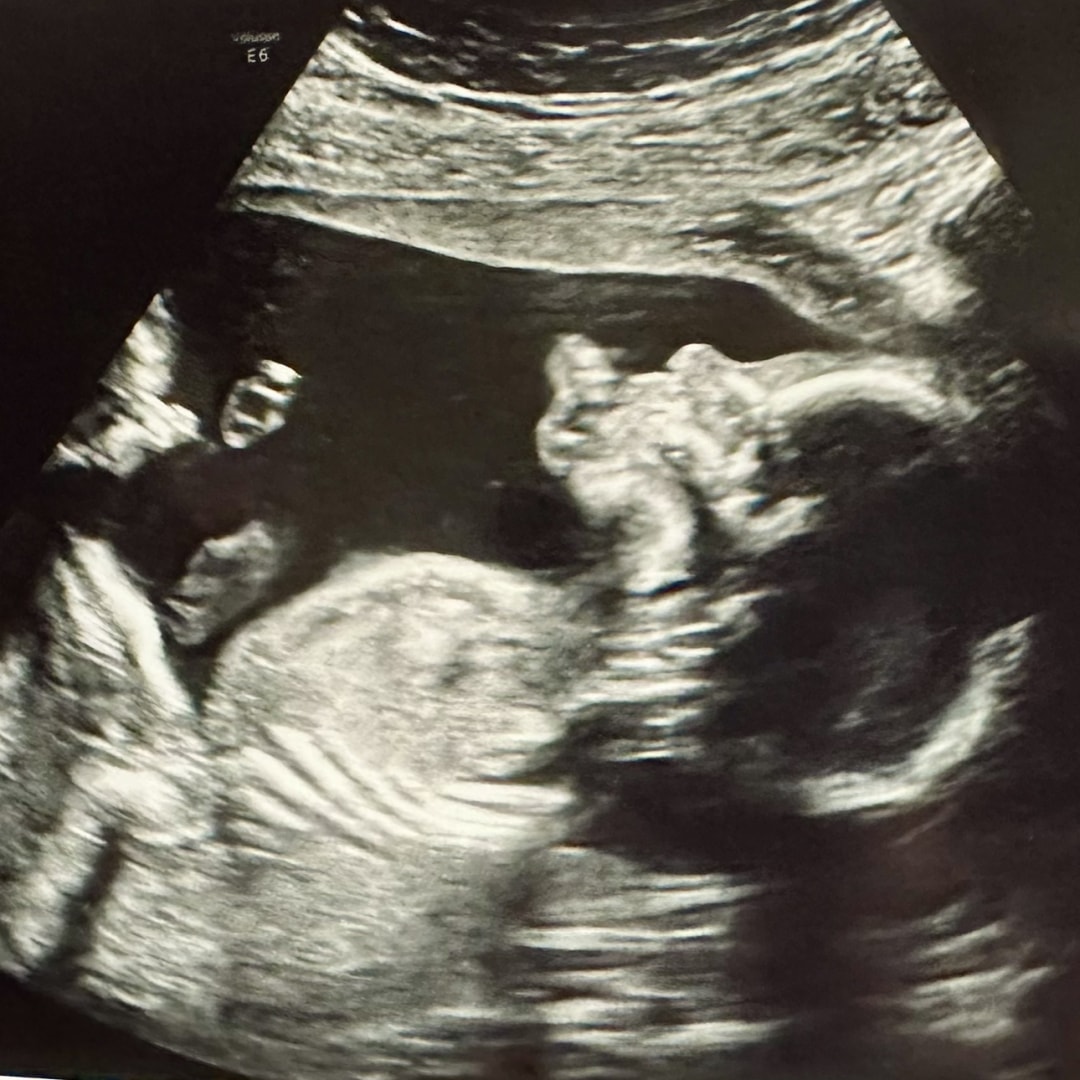 Photo shared by Madeline for their Babylist baby registry.