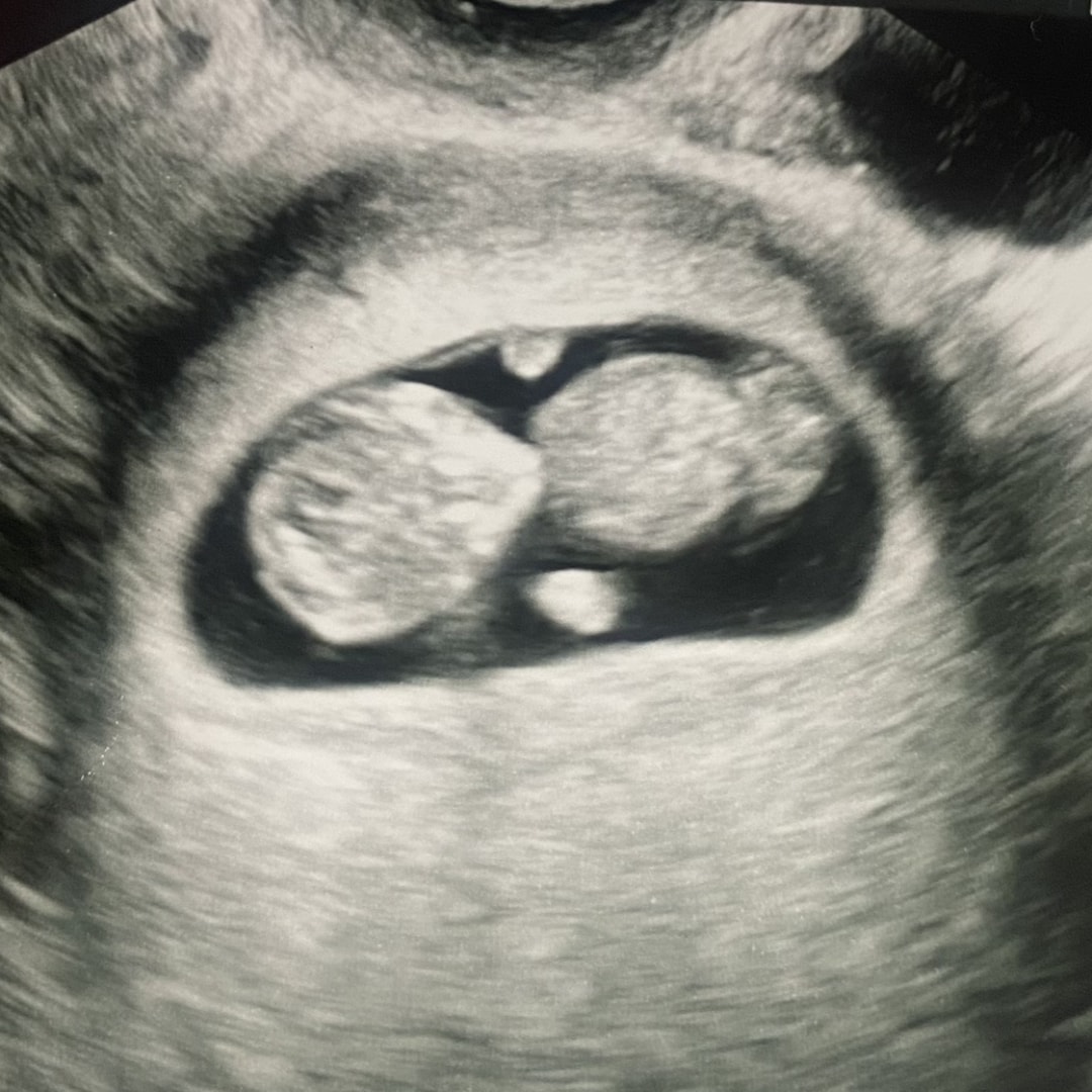 Photo shared by Tessa for their Babylist baby registry.