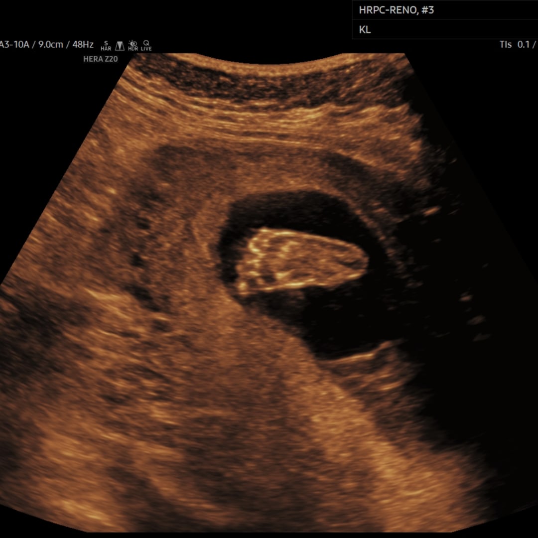Photo shared by Kelsi for their Babylist baby registry.