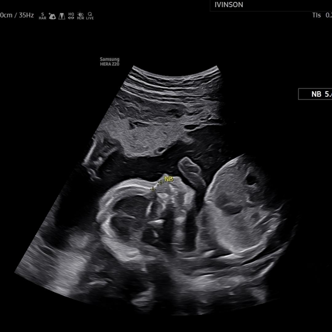 Photo shared by Catherine for their Babylist baby registry.