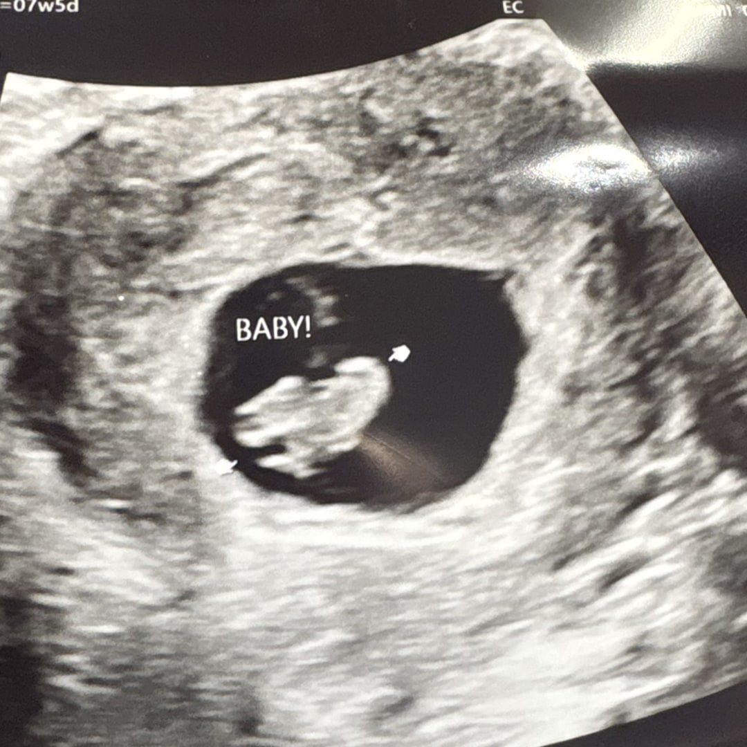 Photo shared by Kelsey for their Babylist baby registry.
