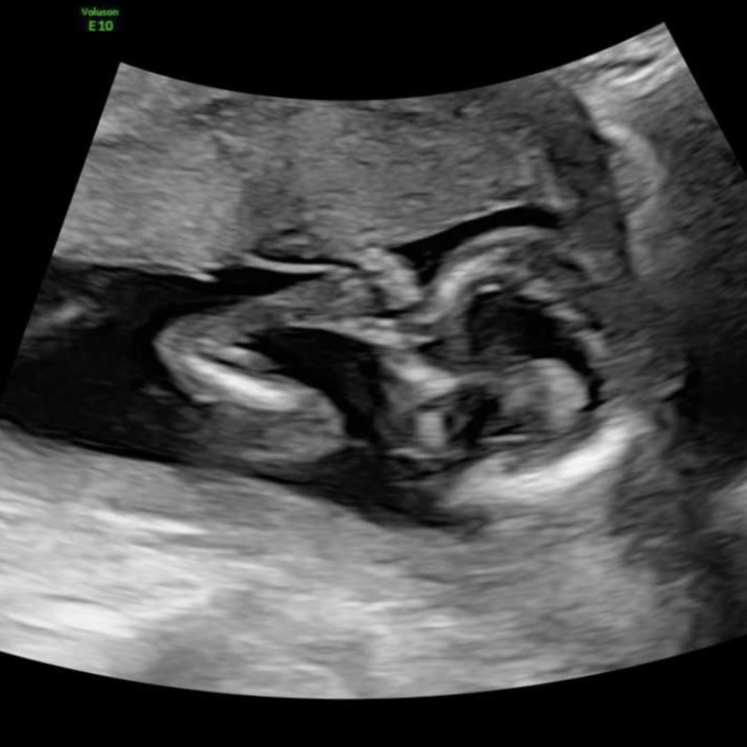 Photo shared by Tamiesha for their Babylist baby registry.