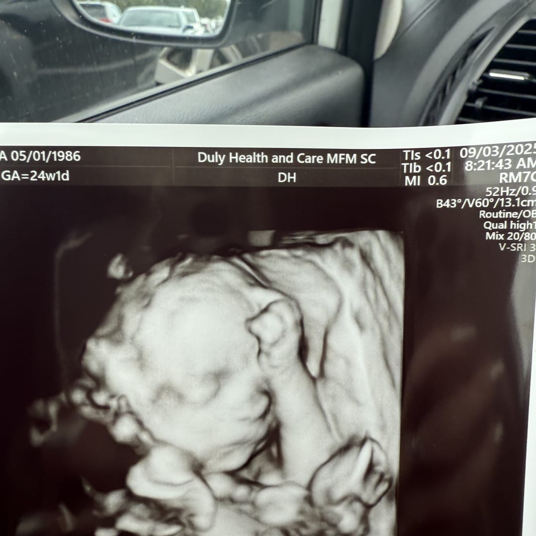 Photo shared by Holly for their Babylist baby registry.