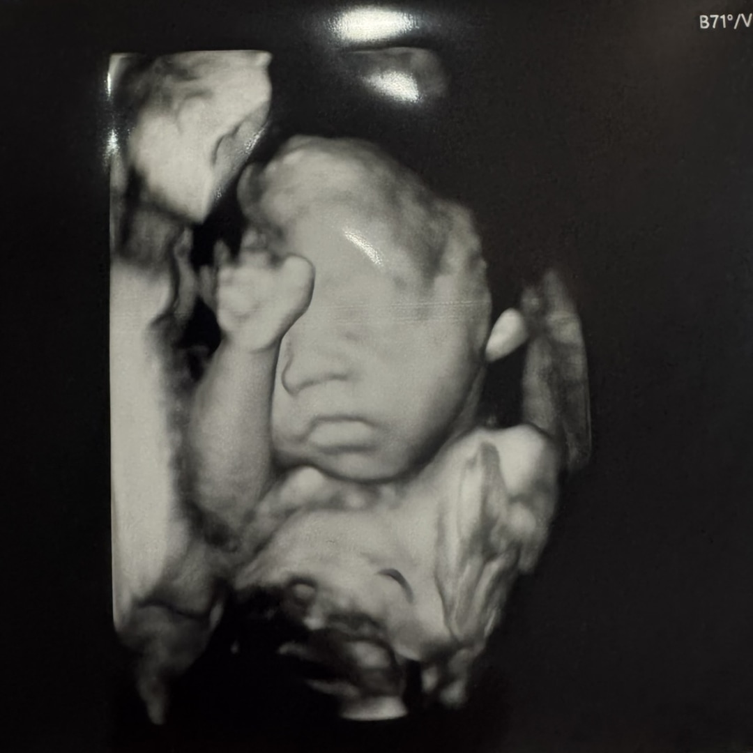 Photo shared by Cassidy for their Babylist baby registry.