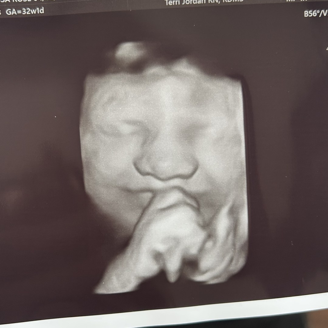 Photo shared by Alyssa for their Babylist baby registry.
