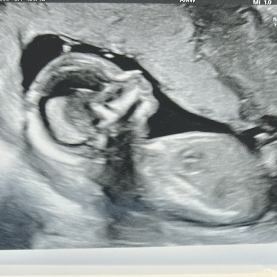 Photo shared by Jessica for their Babylist baby registry.