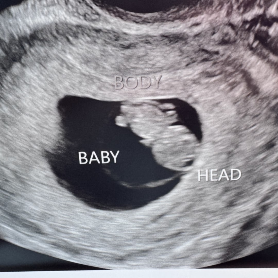 Photo shared by Katelyn for their Babylist baby registry.