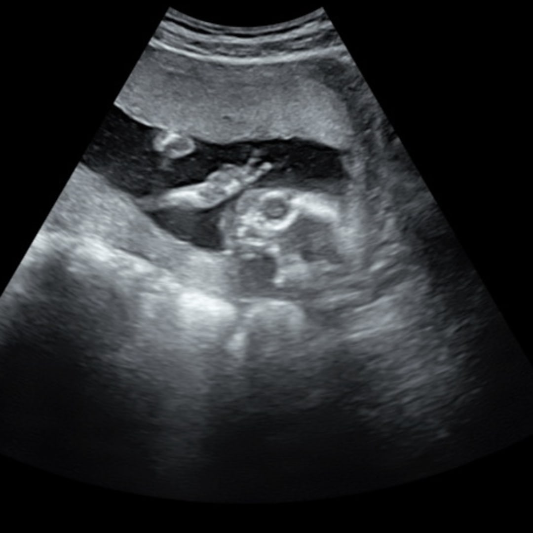 Photo shared by Amilyah for their Babylist baby registry.
