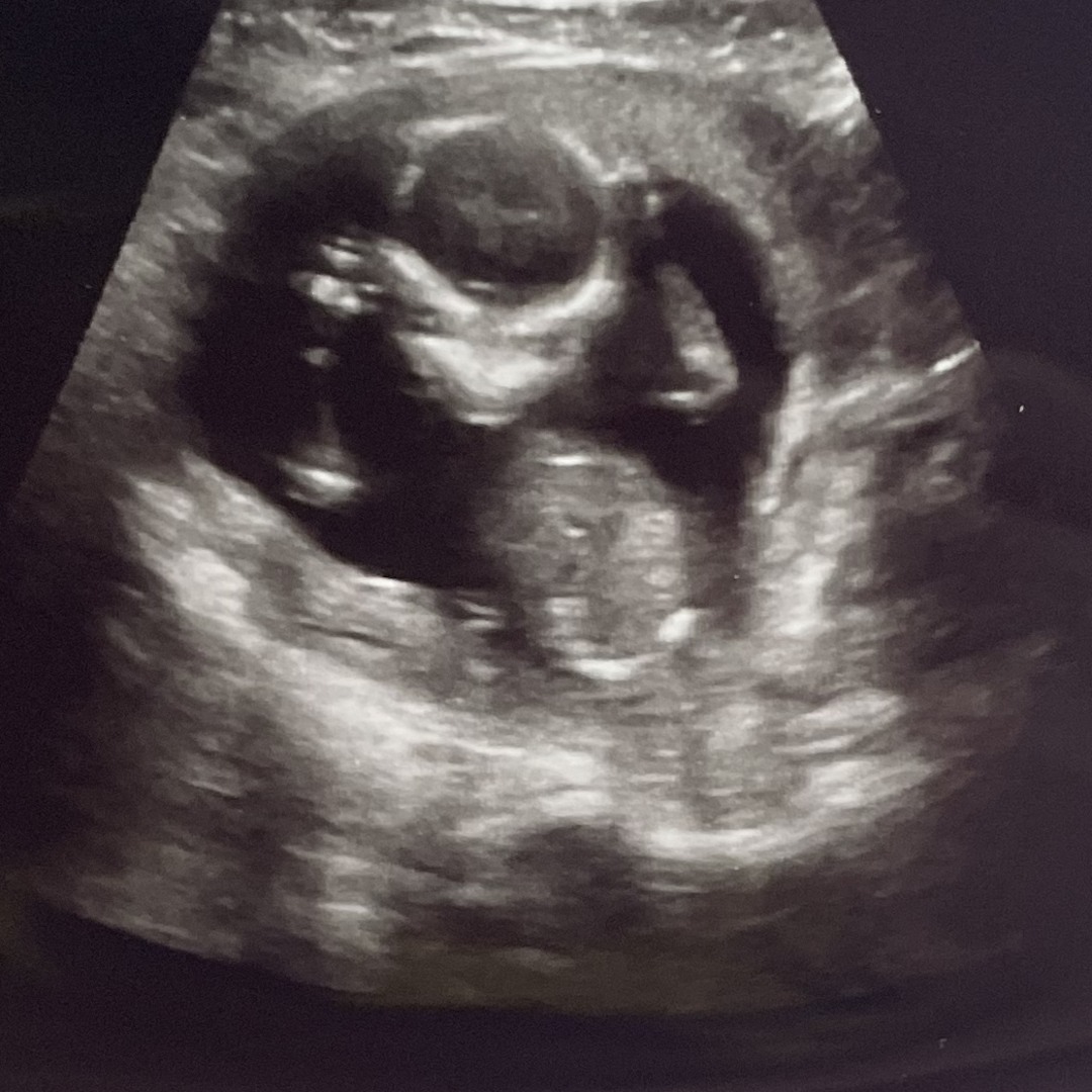 Photo shared by Riley for their Babylist baby registry.