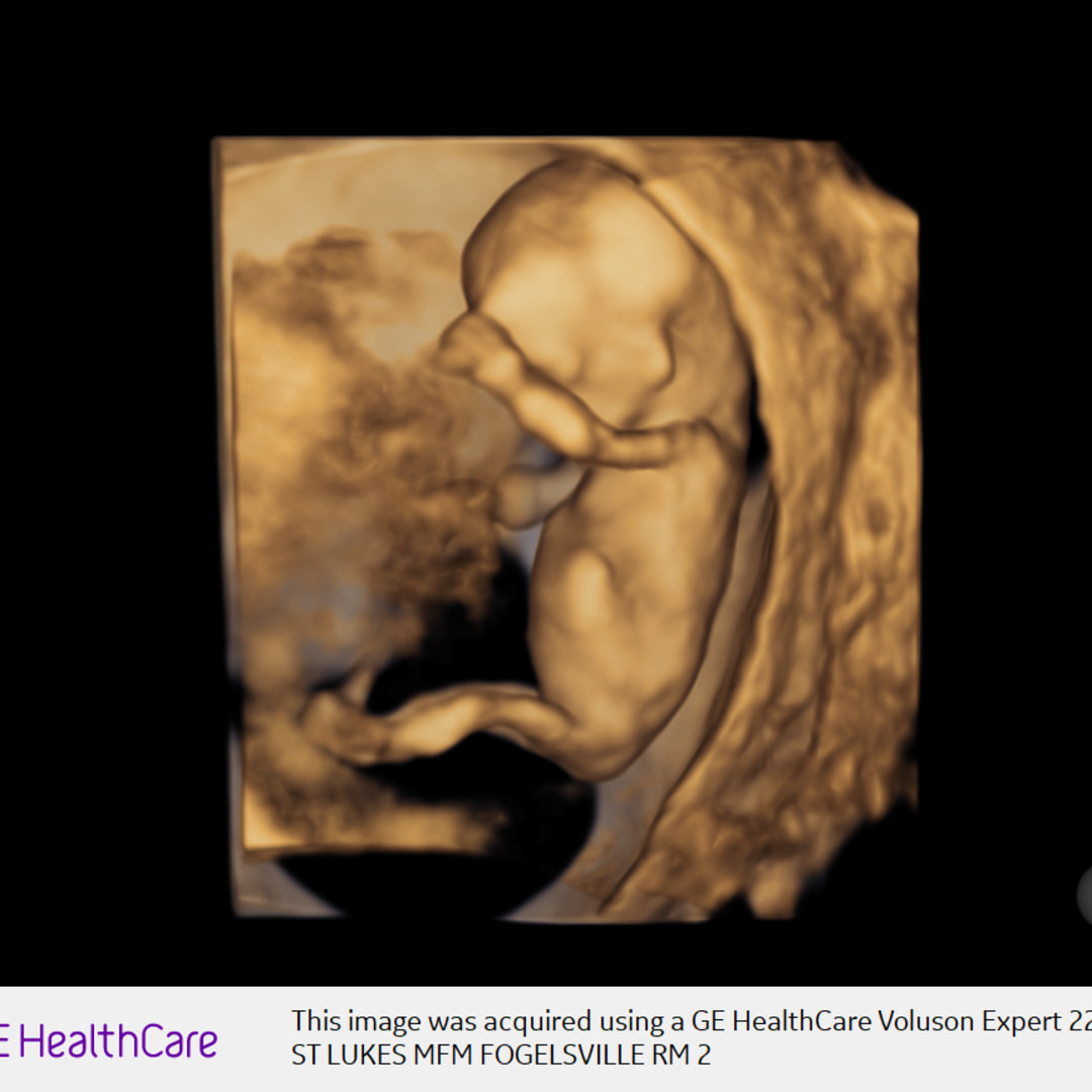 Photo shared by Hunter for their Babylist baby registry.