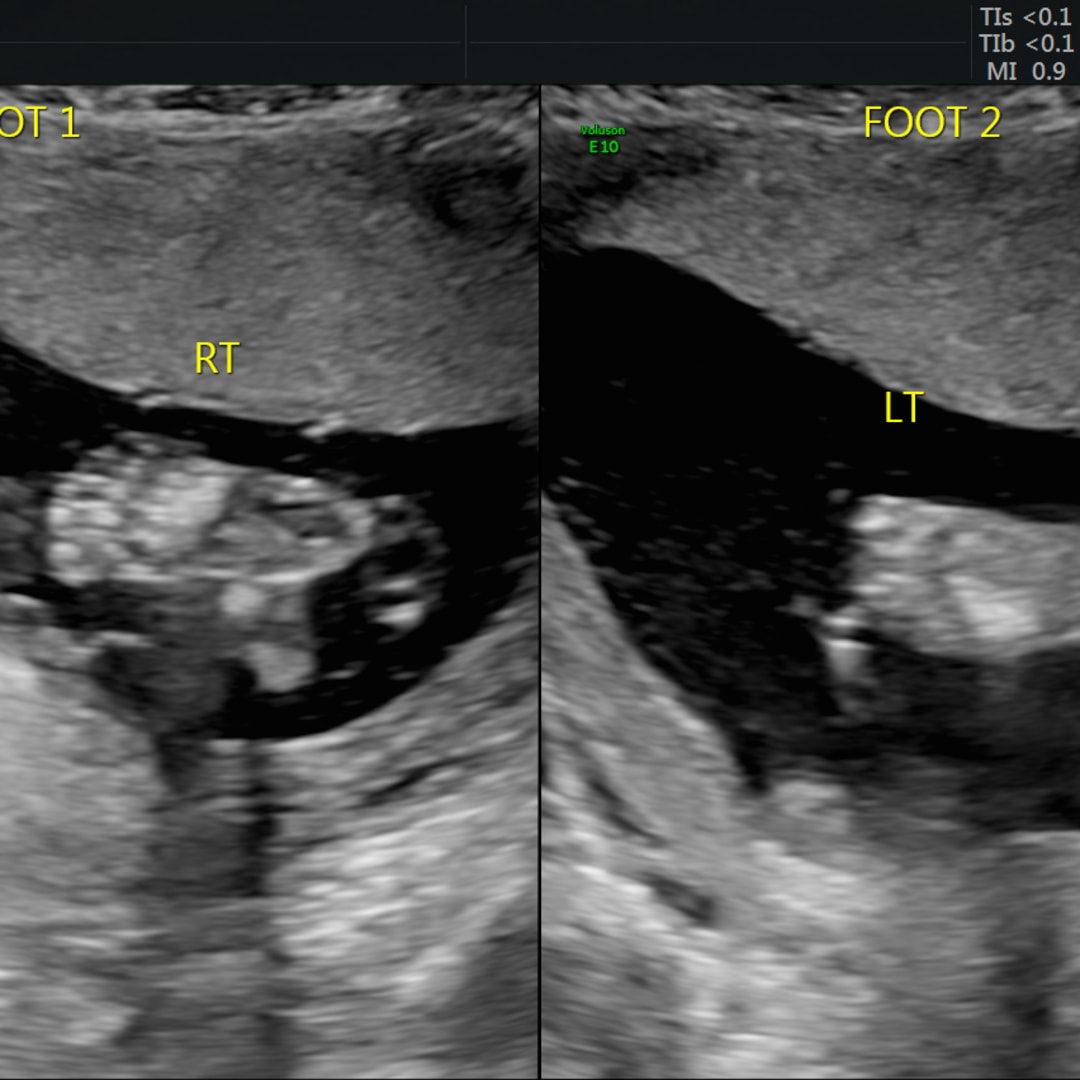 Photo shared by Emily for their Babylist baby registry.