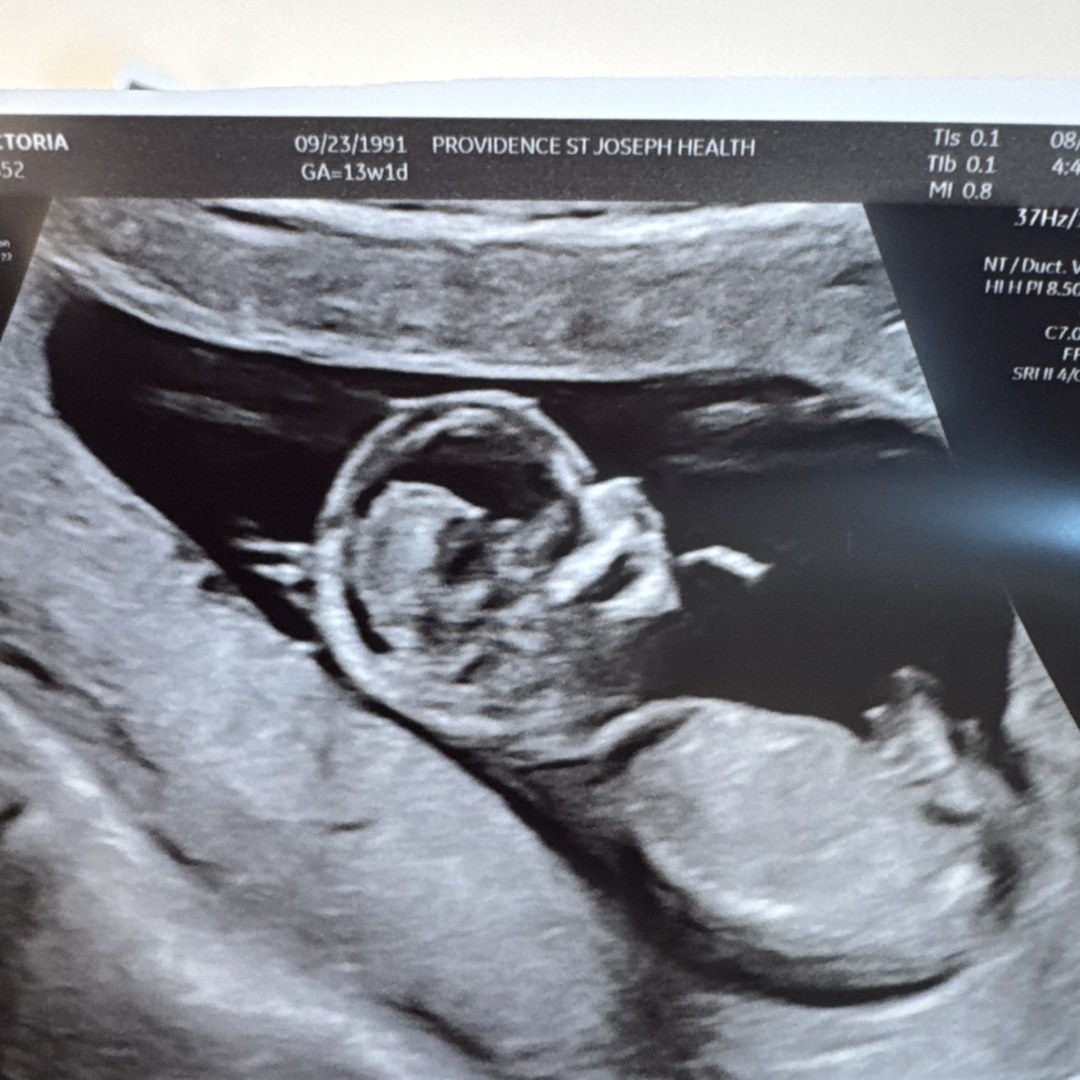 Photo shared by Lisa for their Babylist baby registry.