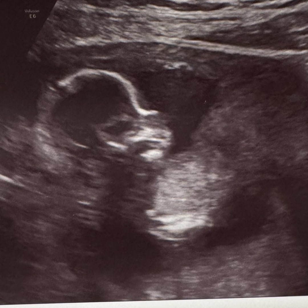 Photo shared by Chelsey for their Babylist baby registry.