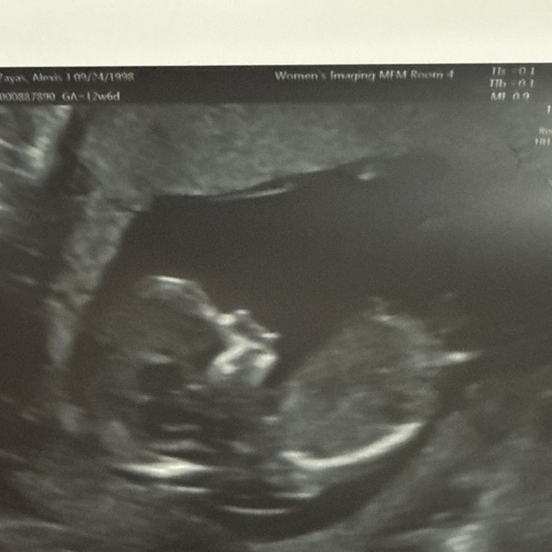 Photo shared by Alexis for their Babylist baby registry.